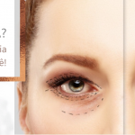 blefaroplastia