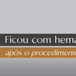 harmonizacao facial curitiba